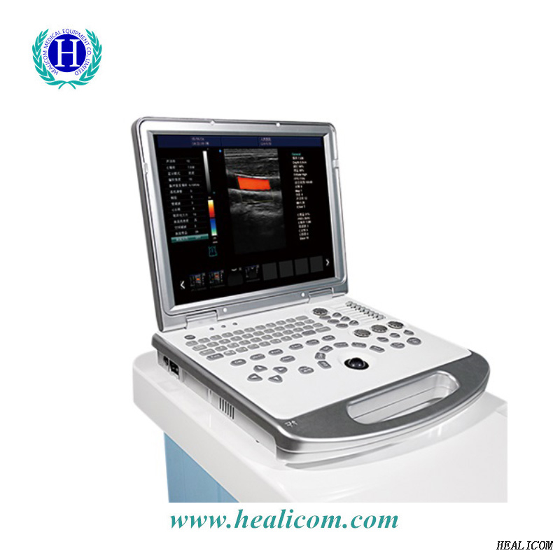 Macchina portatile per scanner ad ultrasuoni Color Doppler per apparecchiature mediche HUC-250