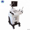 Sistema ad ultrasuoni medico HBW-11 PLUS Scanner a ultrasuoni per carrello completamente digitale da 15 pollici
