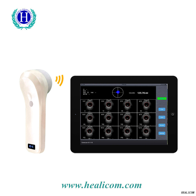 Macchina ad ultrasuoni Scanner senza fili della vescica Mini sonda a ultrasuoni