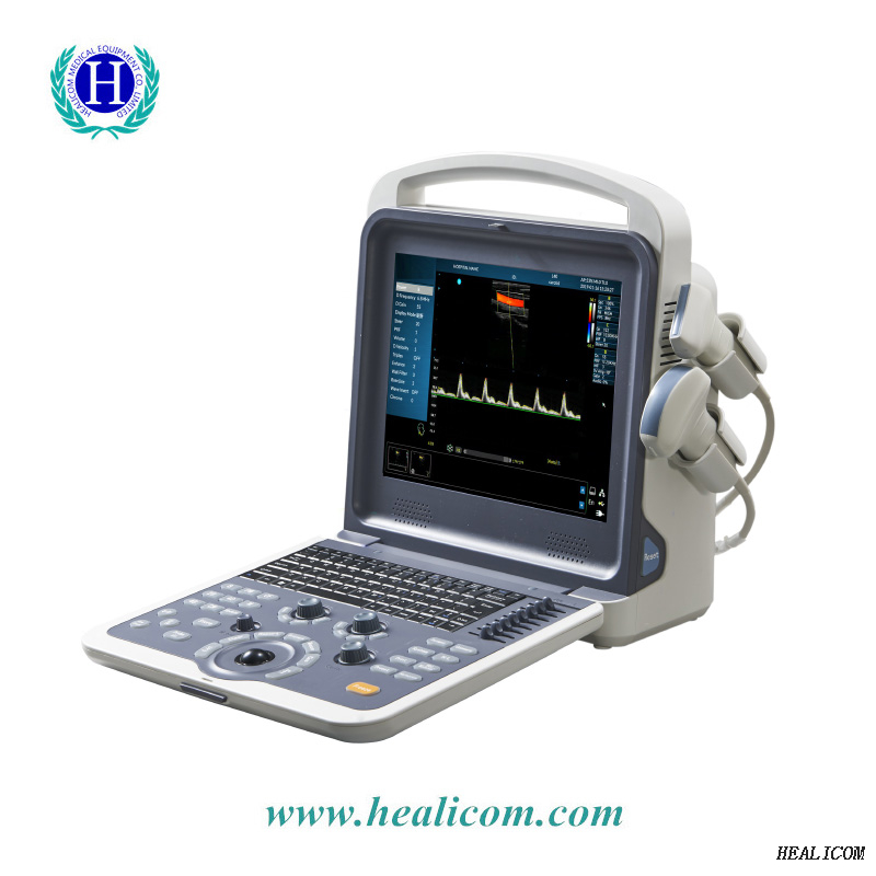 Scanner ad ultrasuoni Doppler a colori completamente digitale portatile di alta qualità HUC-260