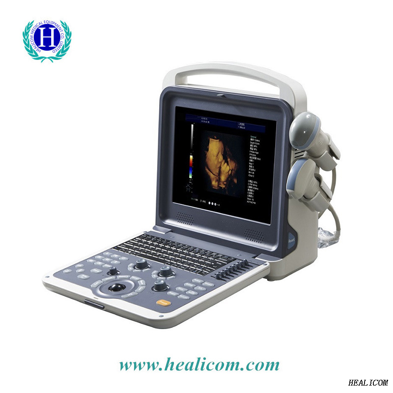 Scanner diagnostico ad ultrasuoni color doppler portatile HUC-300