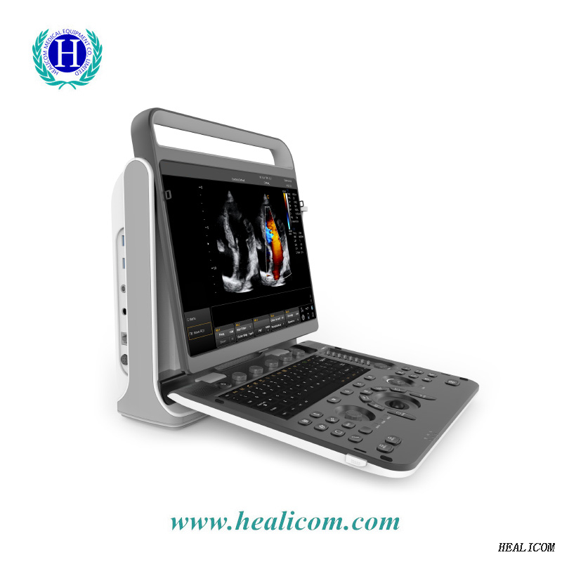 Sistema diagnostico HUC-590 Macchina digitale portatile ad ultrasuoni 3D 4D Color dopplerSistema diagnostico HUC-590 Macchina portatile digitale ad ultrasuoni 3D 4D Color doppler